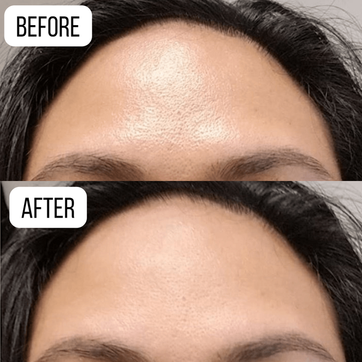 Vulcânica® - Oiliness Remover